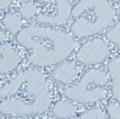 Ref-2